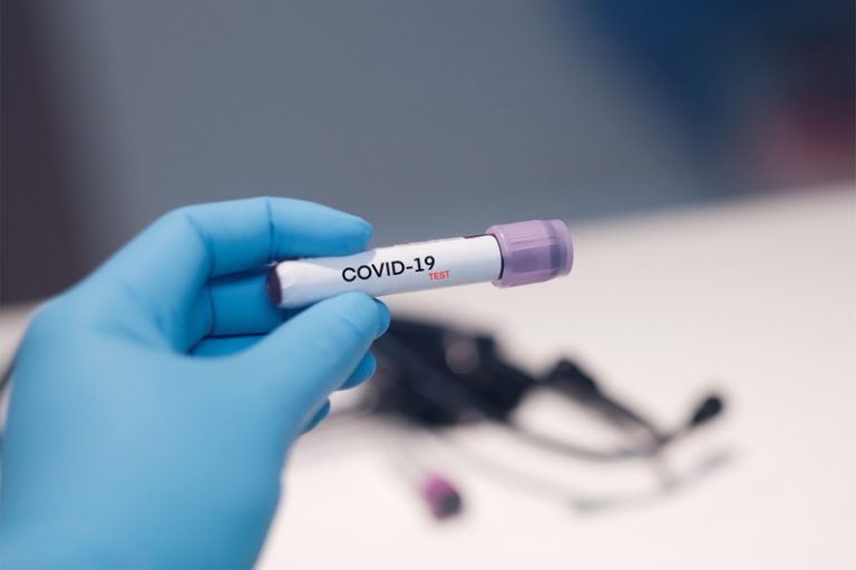 Falta de insumos no mercado global exige utilização criteriosa para testes de covid-19, alerta Abramed